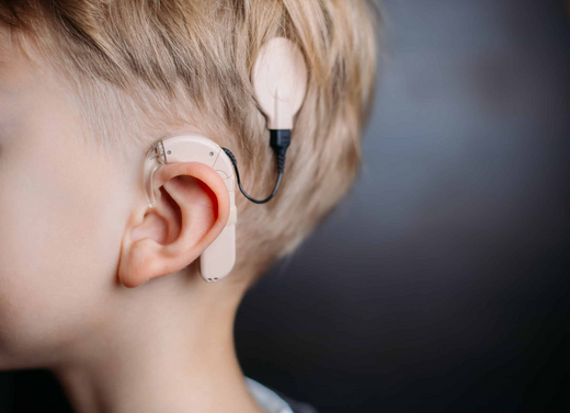 SM Magnetics medical magnet solutions : Cochlear implant in child